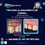 Tips para Alargamiento de corona $USD